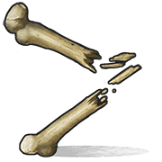 Bone Fragments